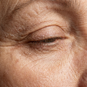 Skin Aging